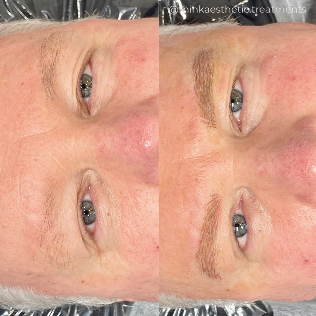 Cosmetic Tattoo before photo of man with sparse brows, with after photo showing tattooed hair strokes using semi-permanent makeup techniques by @thinkaesthetics.treatments