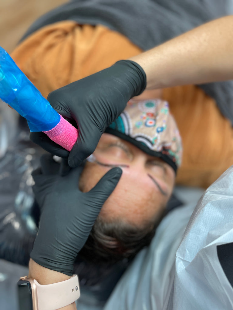 Cosmetic Tattoo Removal in progress with technician Alice McIntosh from THink Aesthetics holding a cosmetic tattoo machine using THink Pigment Remover to remove pmu brows