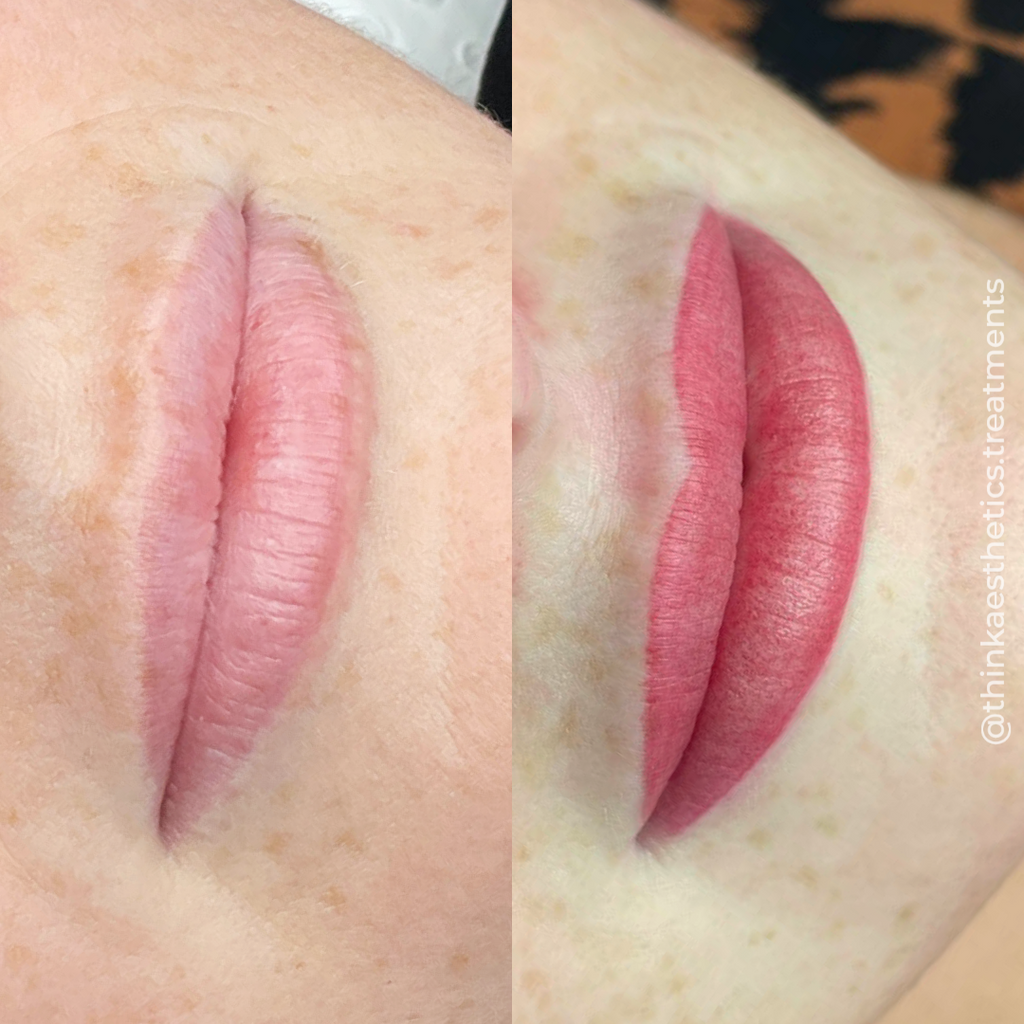 Cosmetic Tattoo before photo of pale lips, with after photo of pink lips using semi-permanent makeup techniques by @thinkaesthetics.treatments