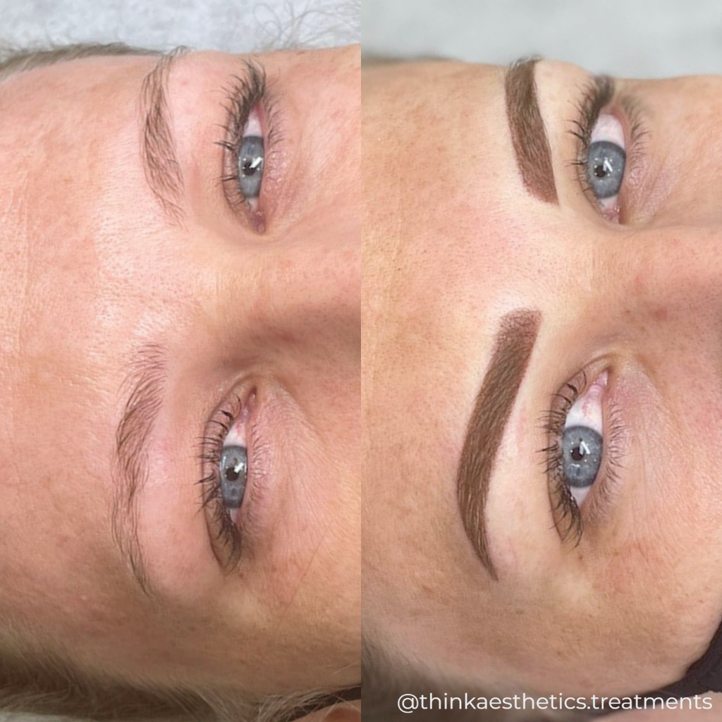 Cosmetic Tattoo before photo of brow and eye area, with after photo showing filled in ombre brows using semi-permanent makeup techniques by @thinkaesthetics.treatments