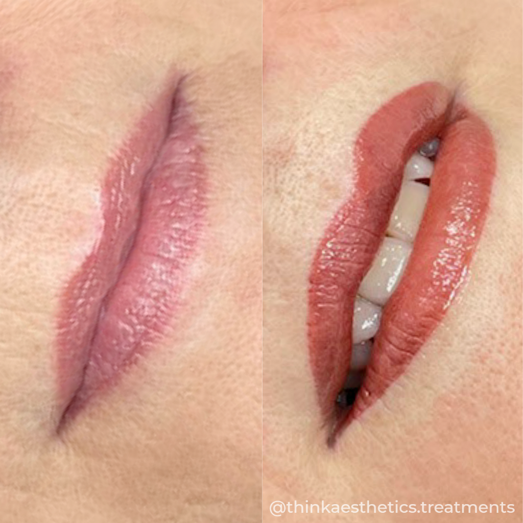 Cosmetic Tattoo before photo of lips, with after photo of open pouted lips using semi-permanent makeup by @thinkaesthetics.treatments