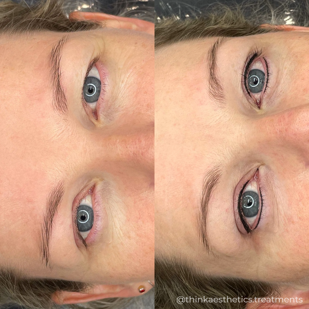 Cosmetic Tattoo before photo of portrait cropped to eyes with after photo showing top and bottom eyeliner using semi-permanent makeup techniques by @thinkaesthetics.treatments